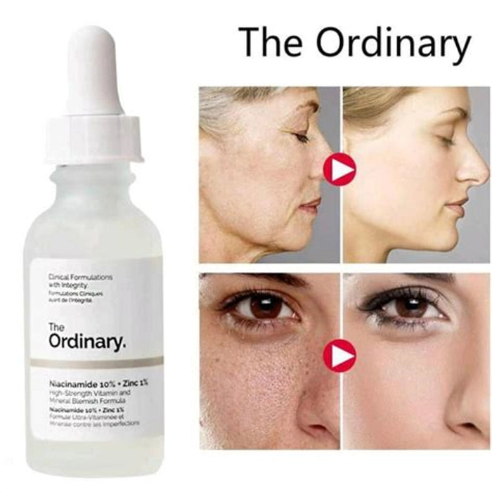 Niacinamide 10%+Zinc 1%