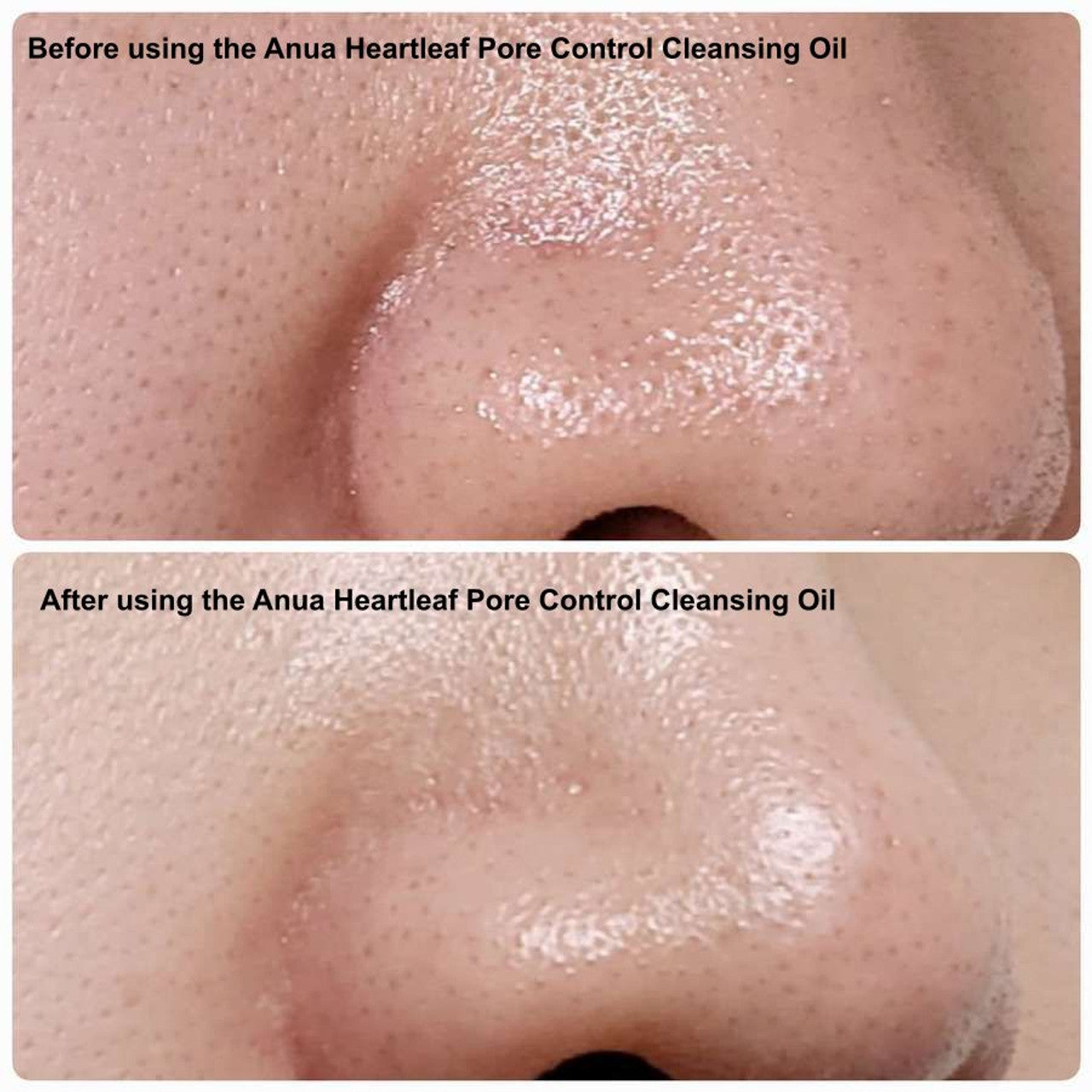 Anua - Heartleaf Quercetinol Pore Deep Cleansing Foam