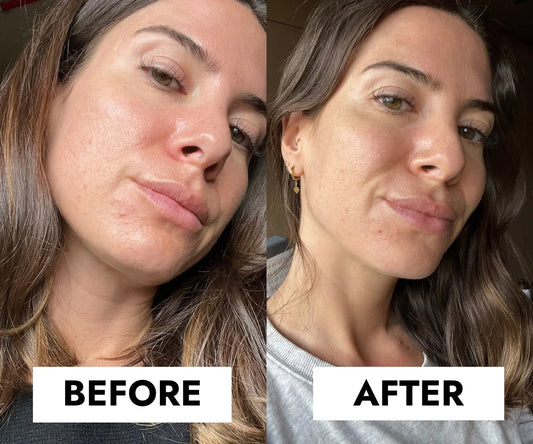 CeraVe Acne Control Cleanser